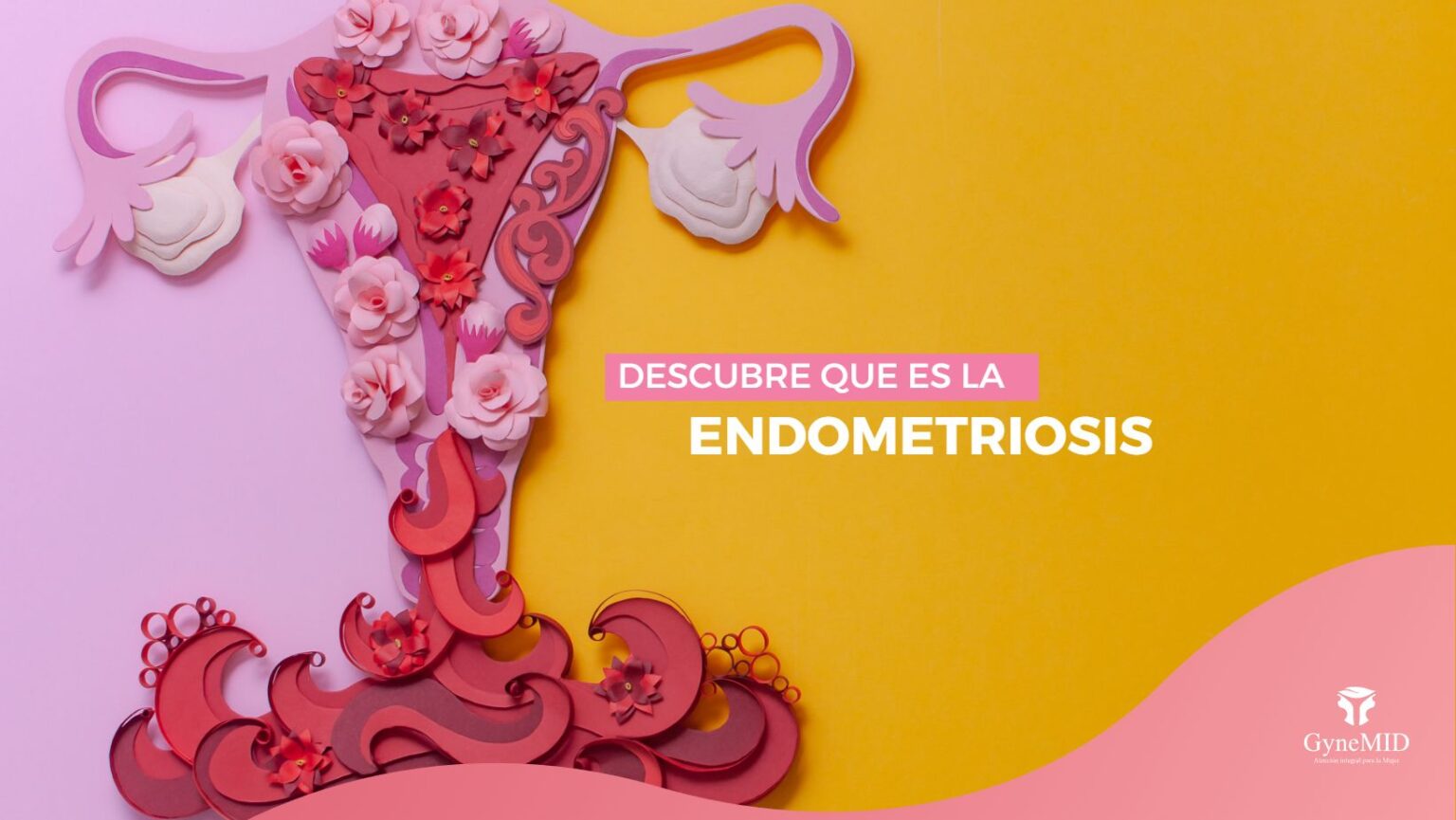Todo Lo Que Necesitas Saber Sobre Endometriosis Gynemid 8276